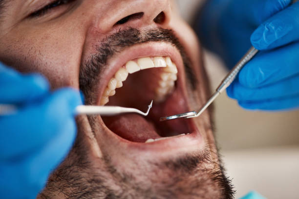 Best Tooth Pain Emergency Relief  in North Bend, OH